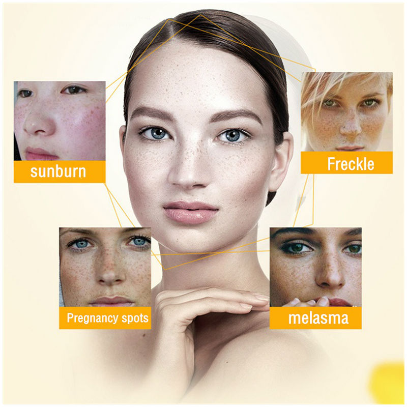 Dimollaure Whitening Freckle C - Skincare Korea 评论和价格