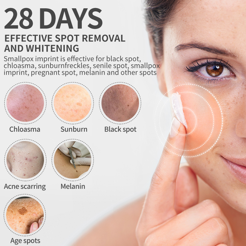 Dimollaure Whitening Freckle C - Skincare Korea 评论和价格
